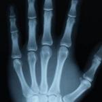 Что такое рентгеновское излучение и как оно используется в медицине Рентгеновское излучение какие частицы